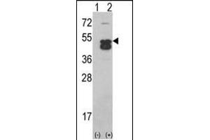 Western blot analysis of CK1D (arrow) using CK1D (CK1 delta)Antibody (C-term) (ABIN391307 and ABIN2841342). (CAMK1D anticorps  (C-Term))