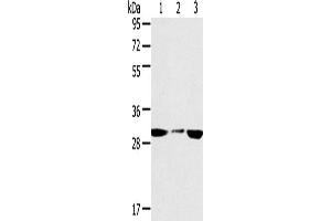 Western Blotting (WB) image for anti-Succinate Dehydrogenase Complex, Subunit B, Iron Sulfur (Ip) (SDHB) antibody (ABIN2433756) (SDHB anticorps)