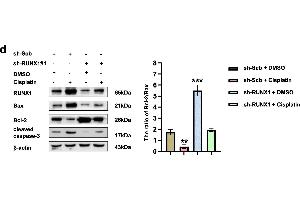 Cisplatin promoted apoptosis by promoting RUNX1 expression in NB cells.