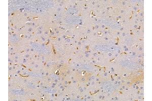 ABIN6259411 and ABIN6276183 at 1/100 staining rat brain tissue by IHC-P.