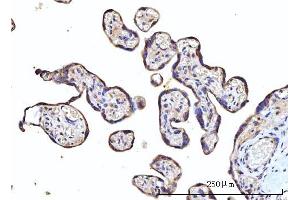 IHC analysis of RPS5 using anti-RPS5 antibody (ABIN7599076). (RPS5 anticorps  (AA 1-204))
