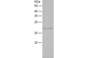 Western Blotting (WB) image for PRP4 Pre-mRNA Processing Factor 4 Homolog (PRPF4) (AA 2-177) protein (His-IF2DI Tag) (ABIN7124354)