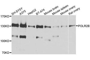 Western blot analysis of extracts of various cell lines, using POLR2B antibody. (POLR2B anticorps  (AA 1-260))