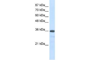 WB Suggested Anti-U1SNRNPBP Antibody Titration:  2. (SNRNP35 anticorps  (N-Term))