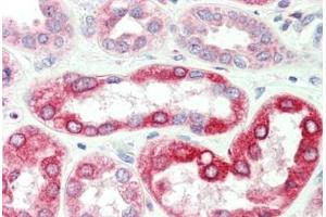 Human, Kidney: Formalin-Fixed Paraffin-Embedded (FFPE)