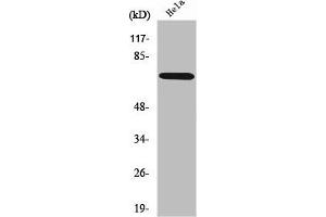 Western Blot analysis of HeLa cells using ABCF2 Polyclonal Antibody
