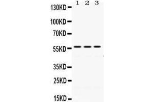Western Blotting (WB) image for anti-Protein Disulfide Isomerase Family A, Member 3 (PDIA3) (AA 471-505), (C-Term) antibody (ABIN3043898) (PDIA3 anticorps  (C-Term))