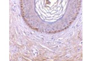 Immunohistochemistry of XEDAR in human skin tissue with this product at 10 μg/ml. (Ectodysplasin A2 Receptor anticorps)