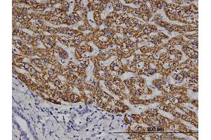 Immunoperoxidase of monoclonal antibody to ELA1 on formalin-fixed paraffin-embedded human liver.