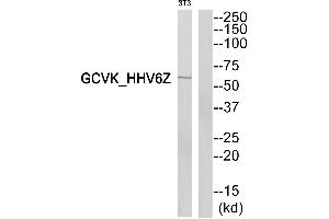 Western blot analysis of extracts from 3T3cells, using GCVK_HHV6Z antibody. (GCVK_HHV6Z anticorps)