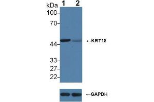 Western blot analysis of (1) Wild-type HeLa cell lysate, and (2) KRT18 knockout HeLa cell lysate, using Rabbit Anti-Human KRT18 Antibody (2 µg/ml) and HRP-conjugated Goat Anti-Mouse antibody ( (Cytokeratin 18 anticorps  (AA 238-396))