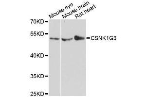 Western blot analysis of extracts of various cell lines, using CSNK1G3 antibody. (CSNK1G3 anticorps  (AA 304-423))