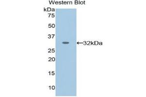 Western blot analysis of the recombinant protein. (EPHA1 anticorps  (AA 716-960))