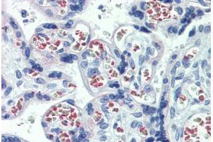 anti-Abhydrolase Domain Containing 5 (ABHD5) (C-Term) antibody
