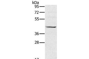 Western Blot analysis of Raji cell using MVK Polyclonal Antibody at dilution of 1:550 (MVK anticorps)
