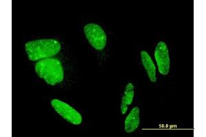 Immunofluorescence of monoclonal antibody to FLJ23834 on HeLa cell. (CDHR3 anticorps  (AA 776-885))