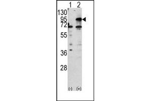 Image no. 1 for anti-Carnitine Palmitoyltransferase 1B (Muscle) (CPT1B) (C-Term) antibody (ABIN357772) (CPT1B anticorps  (C-Term))