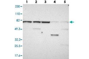 Western blot analysis of Lane 1: RT-4, Lane 2: U-251 MG, Lane 3: Human Plasma, Lane 4: Liver, Lane 5: Tonsil with WDR25 polyclonal antibody  at 1:250-1:500 dilution.