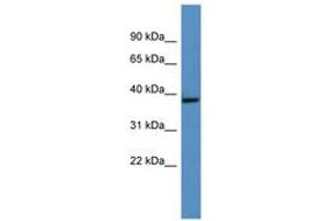 Image no. 1 for anti-Growth Hormone Inducible Transmembrane Protein (GHITM) (AA 161-210) antibody (ABIN6746279) (GHITM anticorps  (AA 161-210))