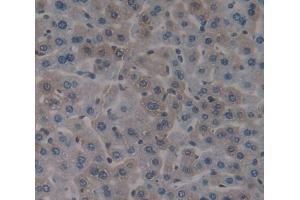 Used in DAB staining on fromalin fixed paraffin- embedded Kidney tissue (EIF2D anticorps  (AA 360-570))