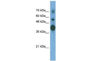 WB Suggested Anti-PTX3 Antibody Titration: 0. (PTX3 anticorps  (N-Term))