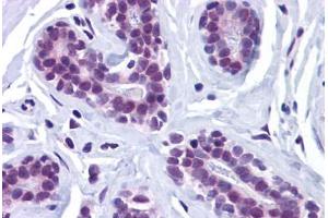 Human Breast: Formalin-Fixed, Paraffin-Embedded (FFPE) (Retinoblastoma Binding Protein 8 anticorps  (Internal Region))