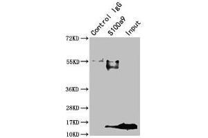 Immunoprecipitating S100a9 in Mouse spleen tissue Lane 1: Rabbit control IgG instead of ABIN7177798 in Mouse spleen tissue. (S1A9 (AA 2-113) anticorps)