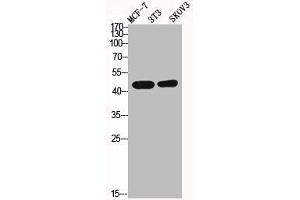 Western Blot analysis of MCF7 NIH-3T3 SKOV3 cells using ICAD Polyclonal Antibody (DFFA anticorps  (Internal Region))