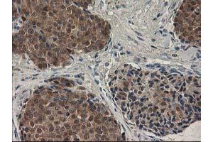 Image no. 2 for anti-Sepiapterin Reductase (SPR) antibody (ABIN1501111)