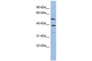 Image no. 1 for anti-Oleoyl-ACP Hydrolase (OLAH) (AA 35-84) antibody (ABIN6744030) (OLAH anticorps  (AA 35-84))
