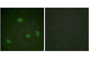 Immunofluorescence analysis of HeLa cells, using Histone H3 (Acetyl-Lys23) Antibody. (Histone 3 anticorps  (H3K23ac))