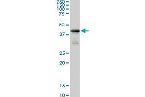 SMAD7 monoclonal antibody (M05), clone 2G6. (SMAD7 anticorps  (AA 160-260))