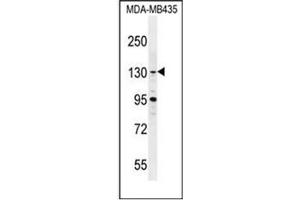 Western blot analysis of GLTSCR1 Antibody (Center) in MDA-MB435 cell line lysates (35ug/lane). (Gltscr1 anticorps  (Middle Region))