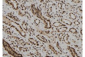 ABIN6273108 at 1/100 staining Human kidney tissue by IHC-P. (DBR1 anticorps)