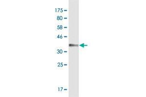 Western Blot detection against Immunogen (35.