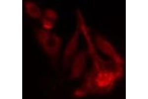 ABIN6277795 staining  Hela cells by IF/ICC. (PRKACB anticorps  (pThr197))