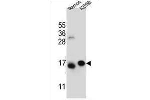 EIF5AL1 Antibody (C-term) western blot analysis in Ramos,A2058 cell line lysates (35µg/lane). (EIF5AL1 anticorps  (C-Term))