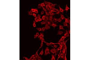 ABIN6267342 staining NIH-3T3 by IF/ICC. (c-MET anticorps  (pTyr1349))