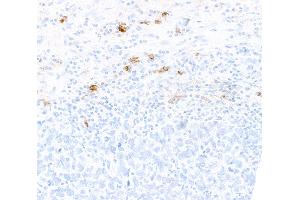 Immunohistochemistry (IHC) image for anti-CD80 (CD80) (AA 35-246) antibody (ABIN7449415) (Recombinant CD80 anticorps  (AA 35-246))