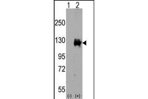 Western blot analysis of TR (arrow) using rabbit polyclonal TR Antibody (C-term) (ABIN392819 and ABIN2842251). (TRPM8 anticorps  (C-Term))