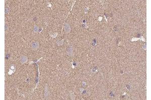 Immunohistochemistry analysis of CD57 antibody in paraffin-embedded human brain tissue. (CD57 anticorps  (N-Term))