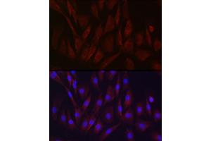 Immunofluorescence analysis of NIH/3T3 cells using TIMP2 Rabbit pAb (ABIN3022132, ABIN3022133, ABIN1513608, ABIN1514751 and ABIN6218618) at dilution of 1:250 (40x lens). (TIMP2 anticorps  (AA 100-200))
