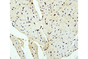 IHC analysis of PTBP2 using anti-PTBP2 antibody (ABIN7599452). (PTBP2 anticorps  (AA 1-504))