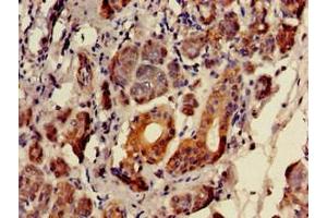 Immunohistochemistry of paraffin-embedded human salivary gland tissue using ABIN7152346 at dilution of 1:100 (SULF2 anticorps  (AA 463-660))