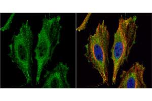 ICC/IF Image Aspartoacylase antibody [N1C3-2] detects Aspartoacylase protein at cytoplasm by immunofluorescent analysis.