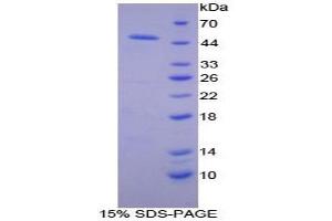 SDS-PAGE of Protein Standard from the Kit  (Highly purified E. (Adiponectin Receptor 2 Kit ELISA)