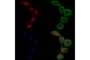 ABIN6263619 and ABIN6278595 staining Hela cells by IF/ICC. (Neurofibromin 1 anticorps)