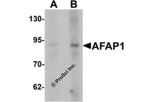 Western Blotting (WB) image for anti-Actin Filament Associated Protein 1 (AFAP1) (N-Term) antibody (ABIN1031217) (AFAP anticorps  (N-Term))