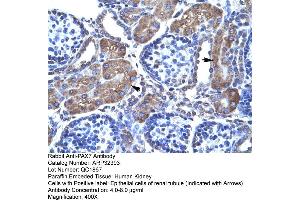 Rabbit Anti-PAX7 Antibody  Paraffin Embedded Tissue: Human Kidney Cellular Data: Epithelial cells of renal tubule Antibody Concentration: 4.
