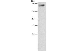 Western Blot analysis of Mouse lung tissue using IQGAP3 Polyclonal Antibody at dilution of 1:850 (IQGAP3 anticorps)
